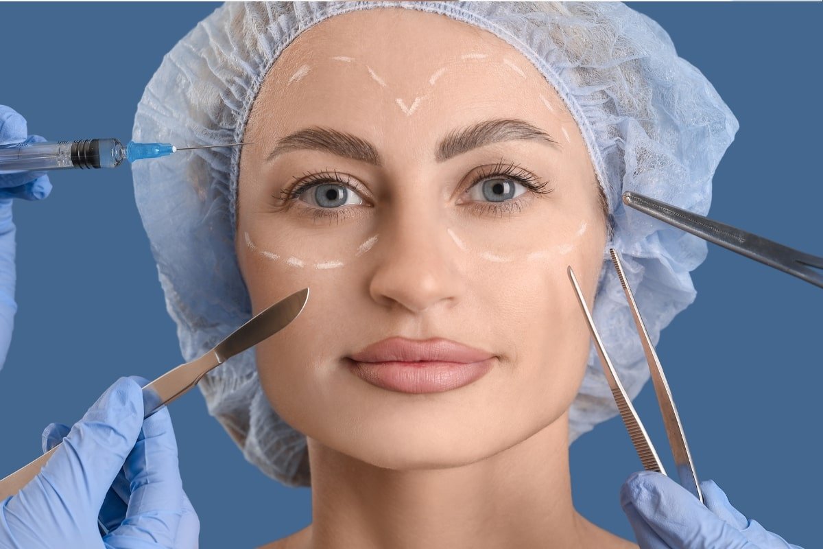 Resultados de blefaroplastia en ojos