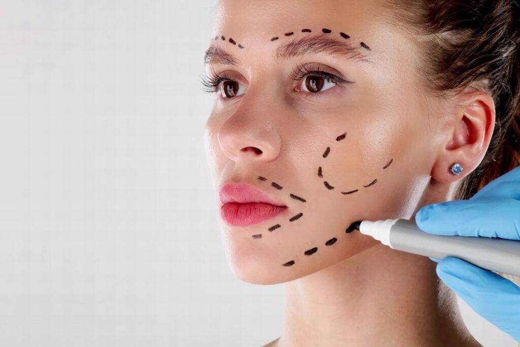 LIFTING FACIAL imagen