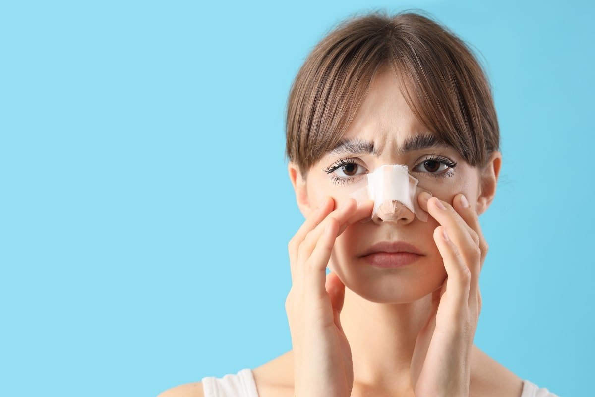 Resultados de rinoplastia en Arte y Cirugía